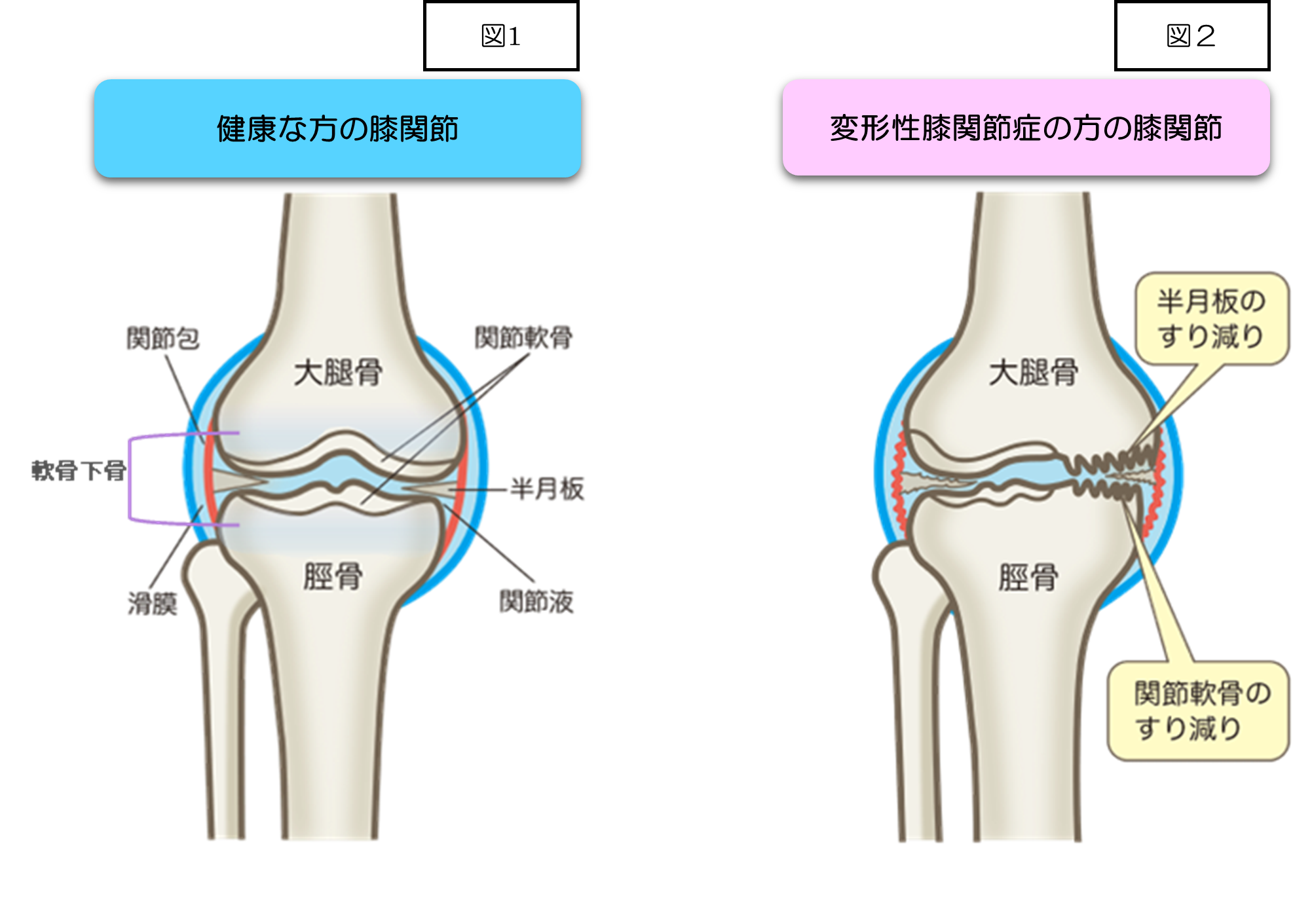 下肢の骨折手術② 膝～足部